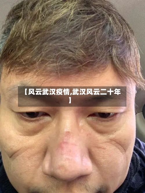 【风云武汉疫情,武汉风云二十年】