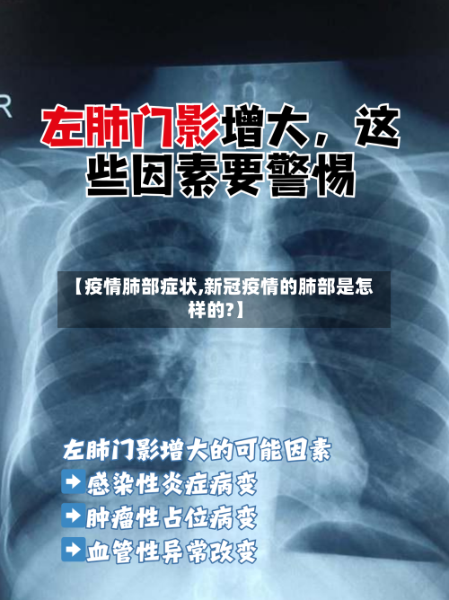 【疫情肺部症状,新冠疫情的肺部是怎样的?】
